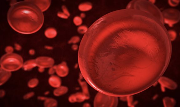 COVID-19: Coagularea sângelui ca simptom